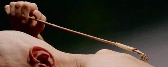 Почему чешется в заднем проходе?