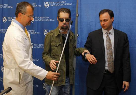 Человек без лица, наконец, может поцеловать свою дочь